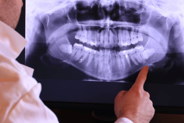 Best Emergency Tooth Extraction in Herrin, IL