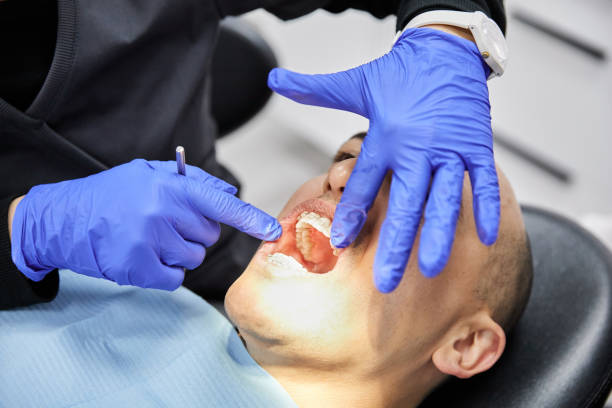 Best Urgent Care for Lost Fillings or Crowns in Herrin, IL